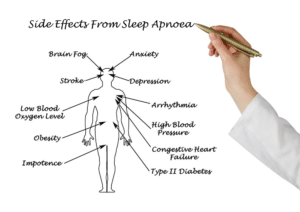 sleep apnoea side effects tmj centre melbourne